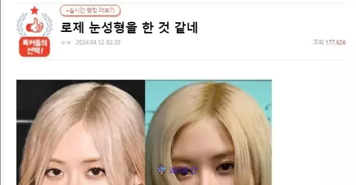 BLACKPINK Rosé疑似割双眼皮手术?网友:”以前比较有魅力” BLACKPINK Rosé疑似割双眼皮手术?网友:”以前比较有魅力”